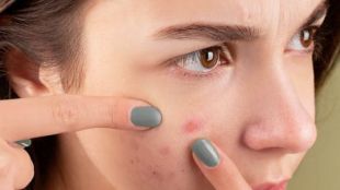 Skin problems due to Vitamin D deficiency