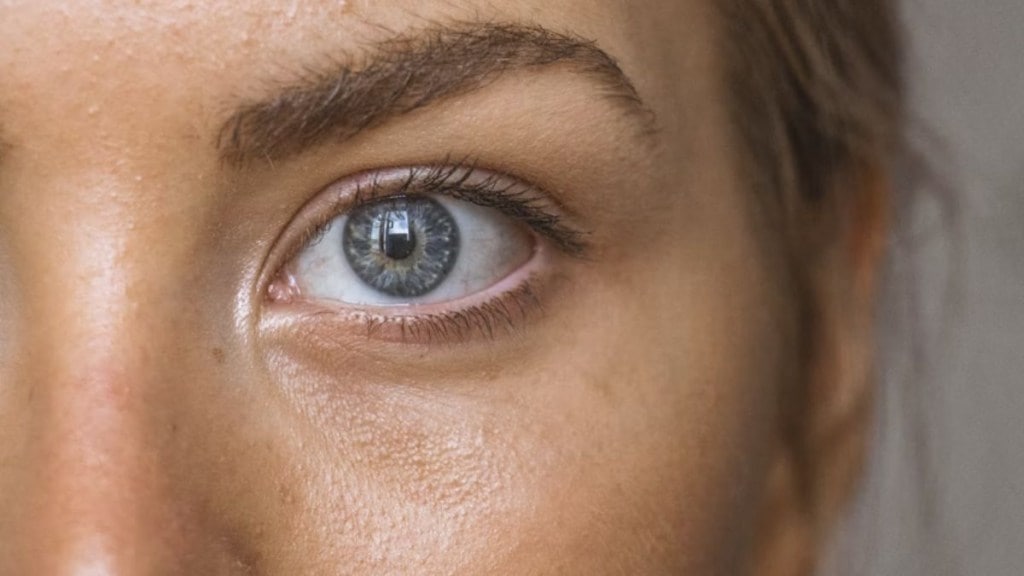 What causes eye floaters