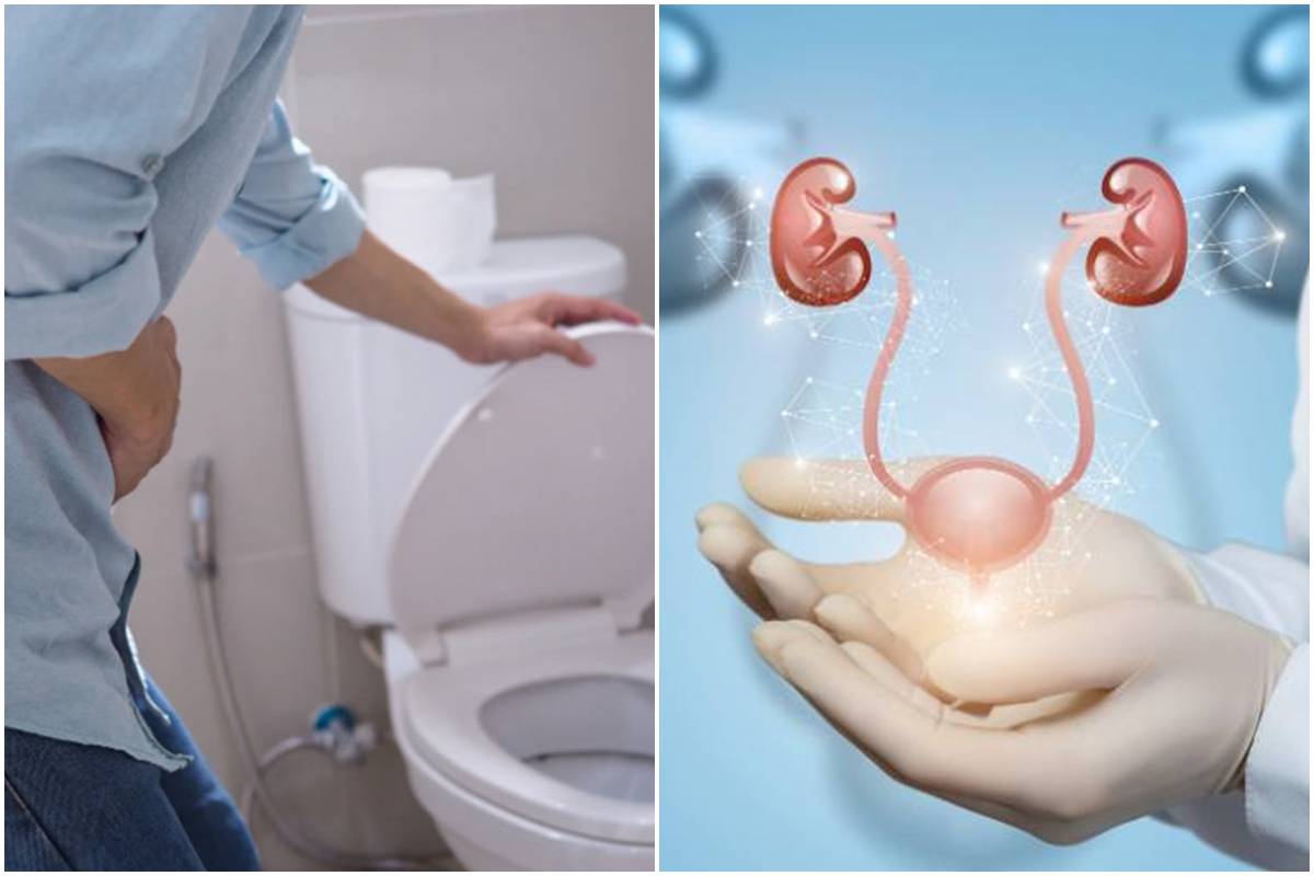habits to manage overactive bladder in pictures