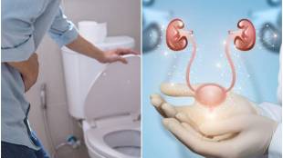 habits to manage overactive bladder in pictures