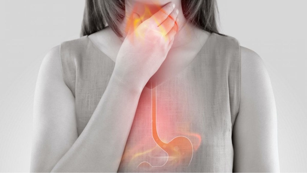 How to ease heartburn naturally
