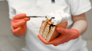 Apart from dry mouth, the GLP-1 medication can also trigger acid reflux and vomiting, which can also damage tooth enamel.