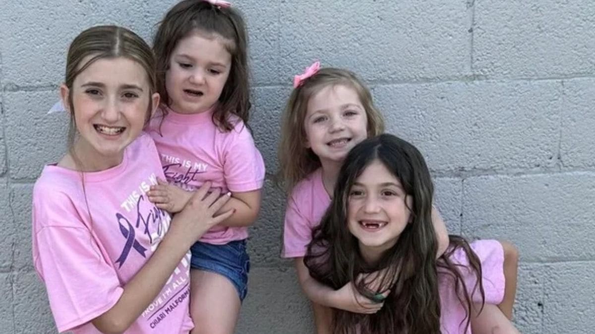 Doctors left puzzled after four American sisters get diagnosed with exact same brain disorder