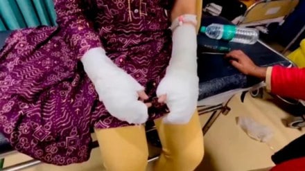 DU student ‘acid attack’ case turns out to be fake; woman’s father staged it using toilet cleaner, say police DU student ‘acid attack’ case turns out to be fake; woman’s father staged it using toilet cleaner, say police