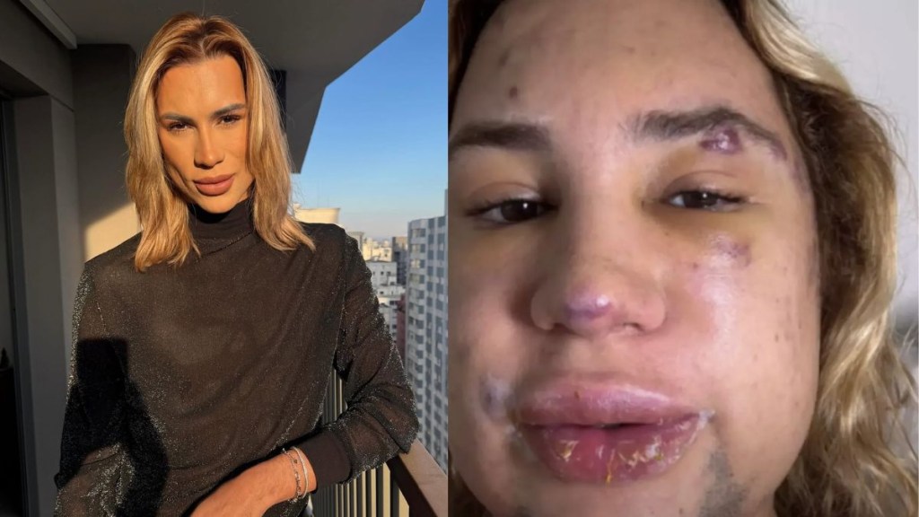 31-year-old instagram influencer dies after dangerous ‘fox eyes’ surgery 31-year-old instagram influencer dies after dangerous ‘fox eyes’ surgery