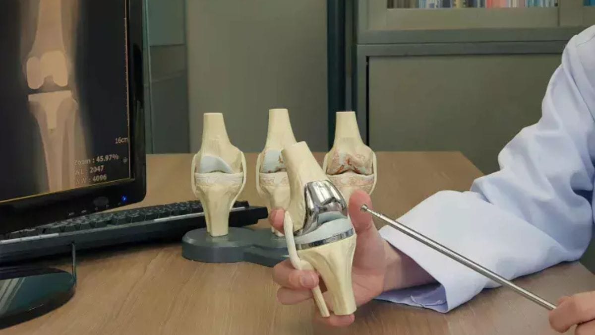 Currently, the price of titanium alloy implant stands at Rs 51,563 whereas the price of revision knee replacement system is Rs 83,547.