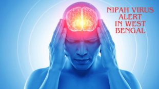Nipah virus