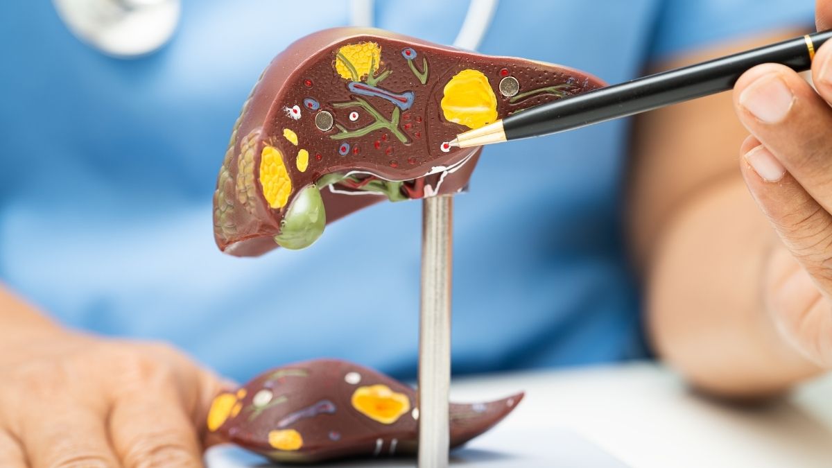 fatty liver alcohol fatty liver alcohol