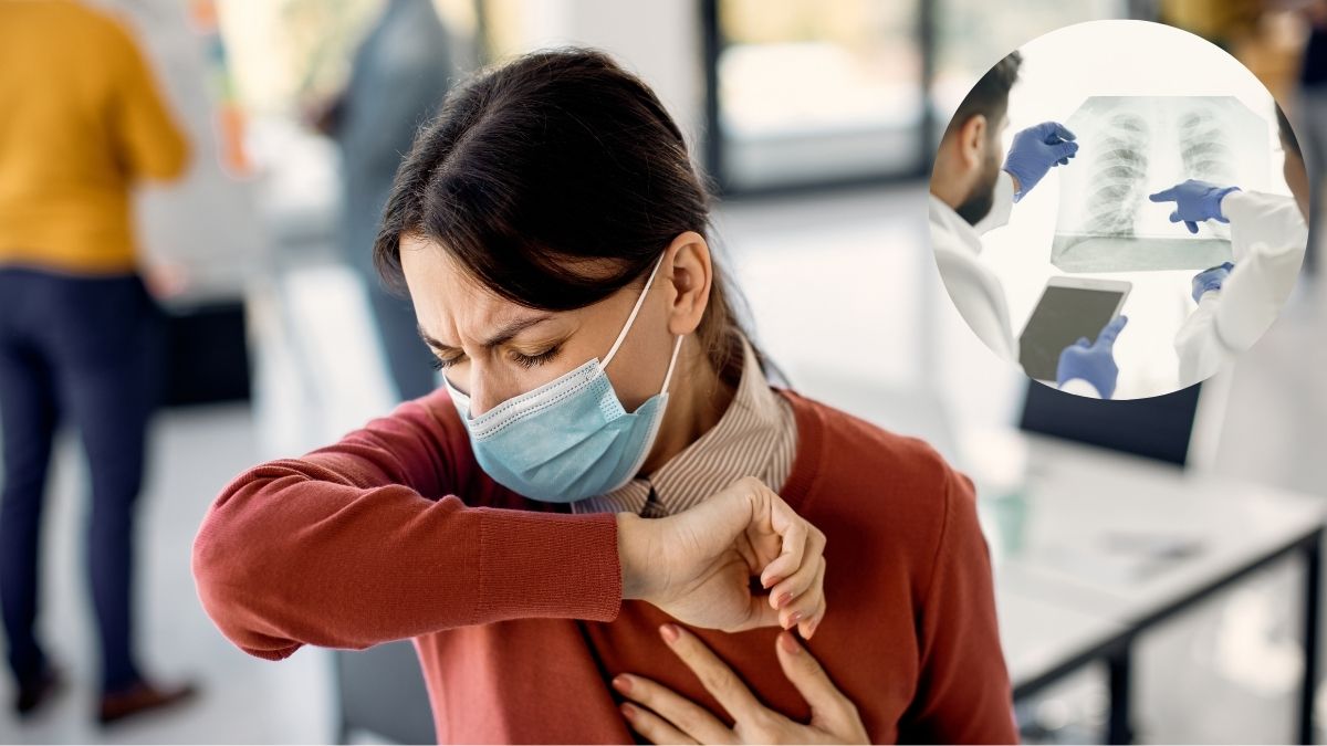 ‘Victorian Disease’ alert: Amazon confirms tuberculosis cases at Coventry warehouse in the UK