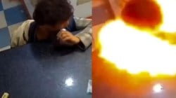 How a ‘moment of stupidity’ with mobile battery left boy seriously injured – Watch