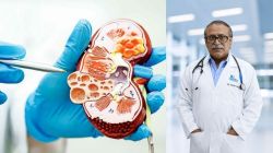 Global chronic kidney cases double, shows Lancet Study