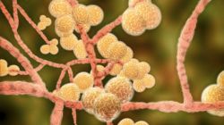 What is Candida auris? Deadly drug-resistant fungus spreads across 23 US states