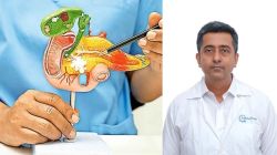 Fatty pancreas often has no symptoms: Who’s at risk and is it linked to cancer? Doctors explain