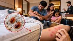 Bed bug bites during hotel stay: Kerala consumer panel orders hotel to pay Rs 60,000