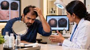 Hair Loss